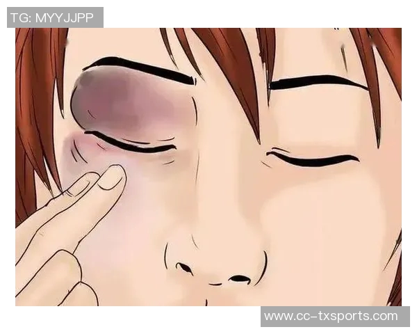 小卡解释鼻子出血原因只是轻微划伤并遭遇眼部意外碰撞 小卡解释鼻子出血原因只是轻微划伤并遭遇眼部意外碰撞